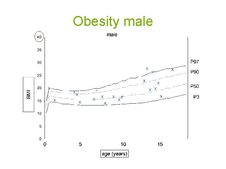 Obesity male 