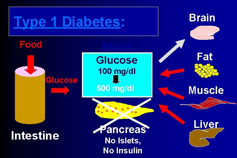 Type 1 Diabetes: Food Blood Glucose Intestine Brain Fat 100 mg/dl 500 mg/dl Pancreas