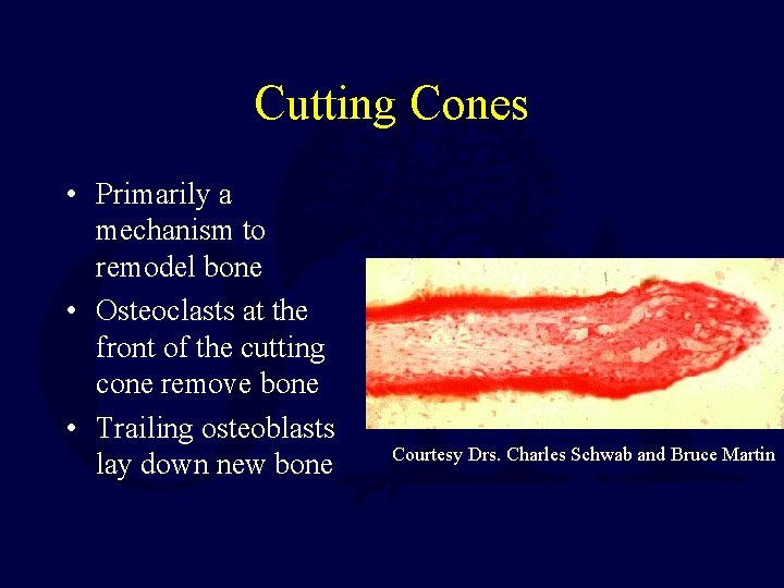 Cutting Cones • Primarily a mechanism to remodel bone • Osteoclasts at the front