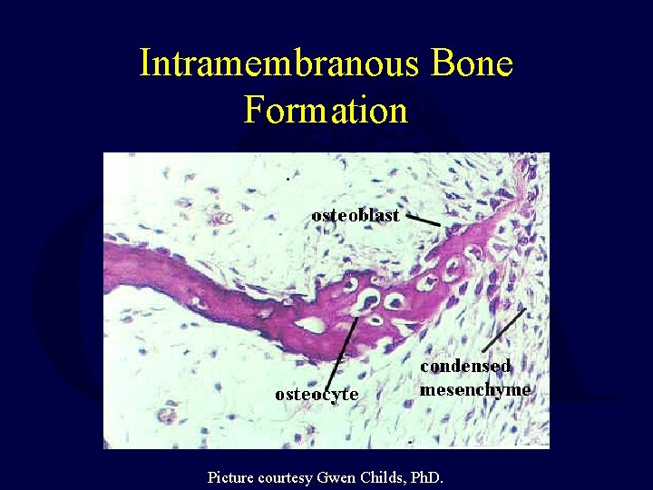 Intramembranous Bone Formation Picture courtesy Gwen Childs, Ph. D. 