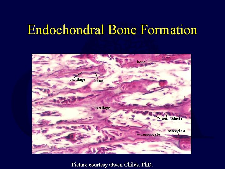 Endochondral Bone Formation Picture courtesy Gwen Childs, Ph. D. 