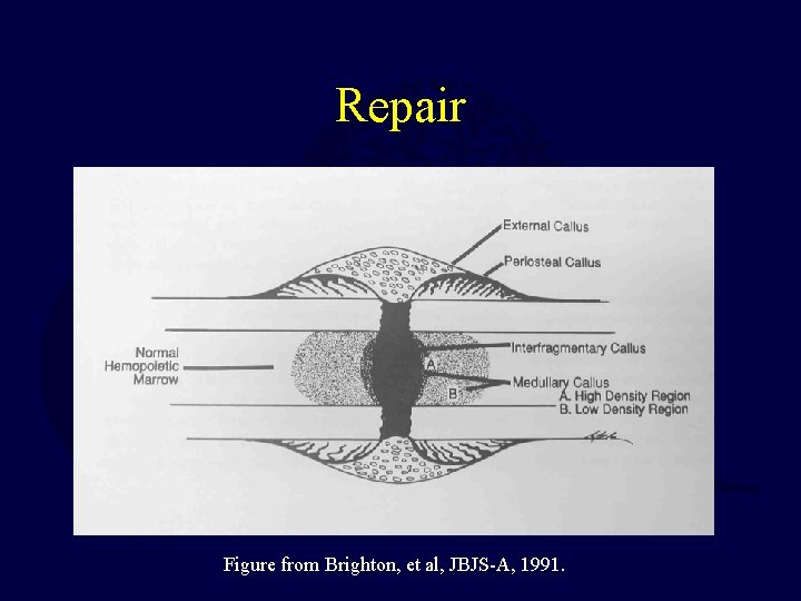 Repair Figure from Brighton, et al, JBJS-A, 1991. 