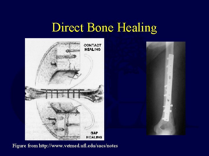 Direct Bone Healing Figure from http: //www. vetmed. ufl. edu/sacs/notes 