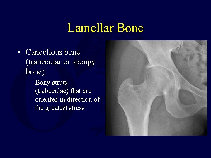 Lamellar Bone • Cancellous bone (trabecular or spongy bone) – Bony struts (trabeculae) that