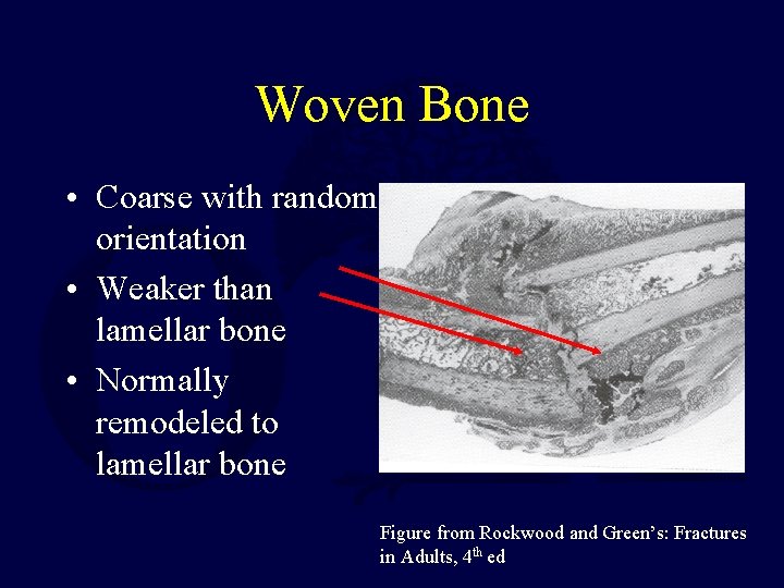 Woven Bone • Coarse with random orientation • Weaker than lamellar bone • Normally