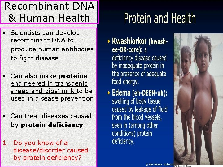 Recombinant DNA & Human Health • Scientists can develop recombinant DNA to produce human Recombinant DNA & Human Health • Scientists can develop recombinant DNA to produce human