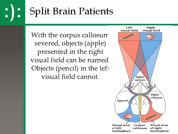 Split Brain Patients With the corpus callosum severed, objects (apple) presented in the right