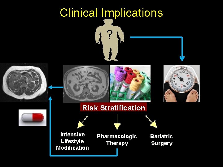 Clinical Implications ? Risk Stratification Intensive Lifestyle Modification Pharmacologic Therapy Bariatric Surgery 