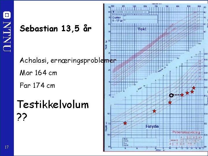 Sebastian 13, 5 år Achalasi, ernæringsproblemer Mor 164 cm Far 174 cm Testikkelvolum ?