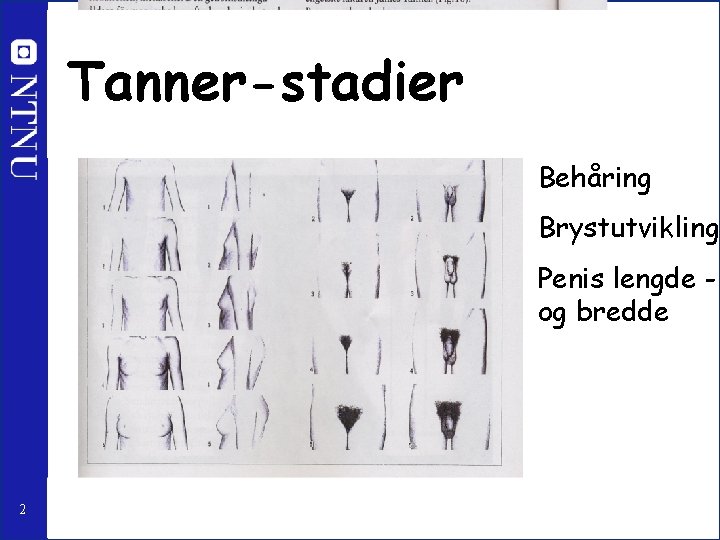 Tanner-stadier Behåring Brystutvikling Penis lengde og bredde 2 