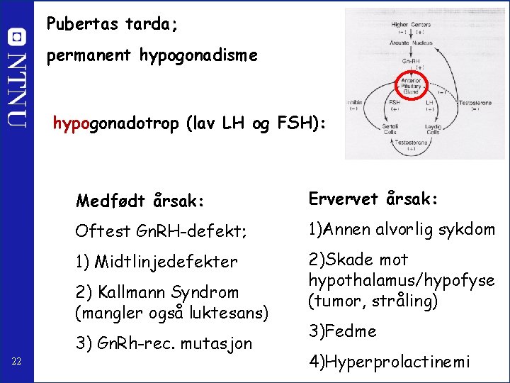 Pubertas tarda; permanent hypogonadisme hypogonadotrop (lav LH og FSH): Medfødt årsak: Ervervet årsak: Oftest