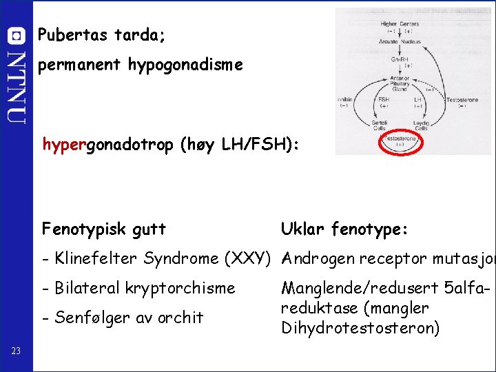 Pubertas tarda; permanent hypogonadisme hypergonadotrop (høy LH/FSH): Fenotypisk gutt Uklar fenotype: - Klinefelter Syndrome