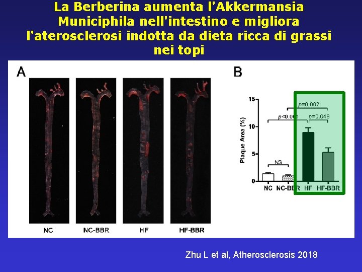 La Berberina aumenta l'Akkermansia Municiphila nell'intestino e migliora l'aterosclerosi indotta da dieta ricca di