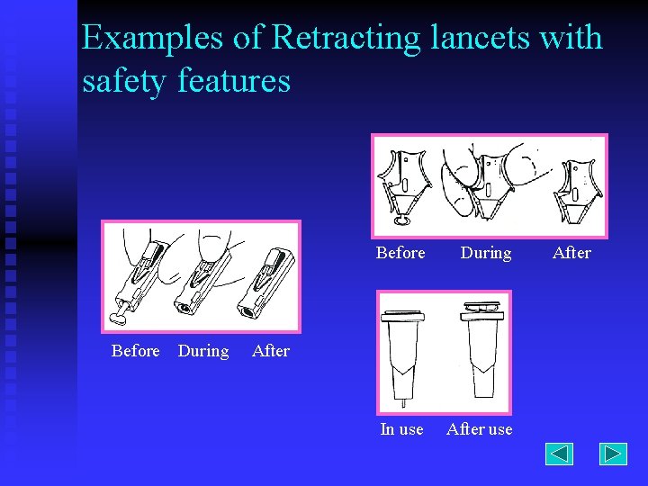 Examples of Retracting lancets with safety features Before During In use After 