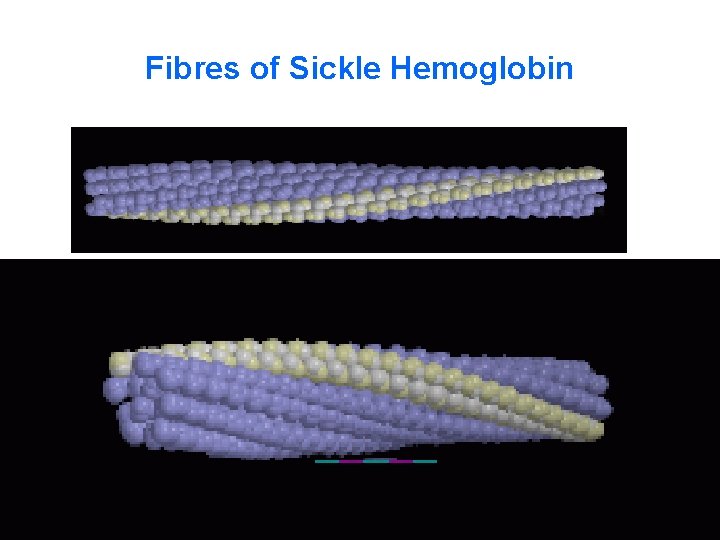 Fibres of Sickle Hemoglobin 