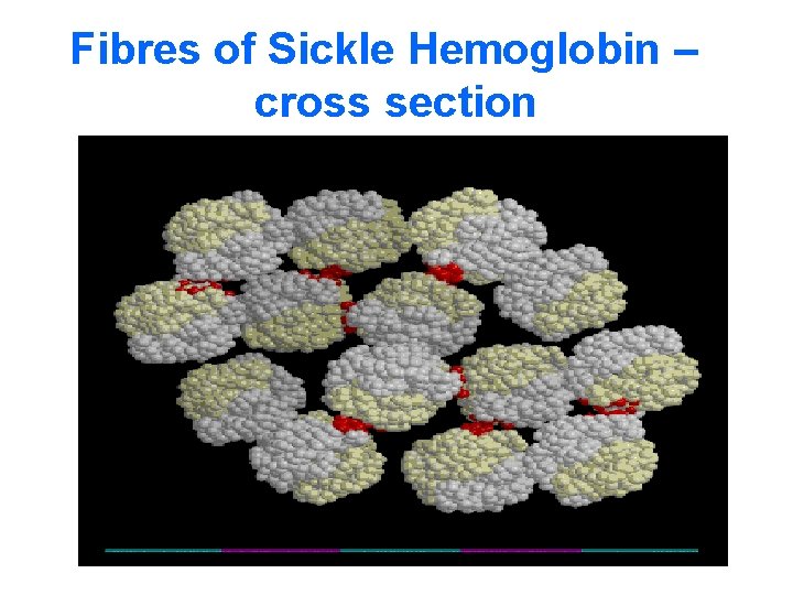 Fibres of Sickle Hemoglobin – cross section 