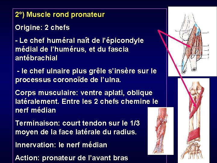 2°) Muscle rond pronateur Origine: 2 chefs - Le chef huméral naît de l’épicondyle