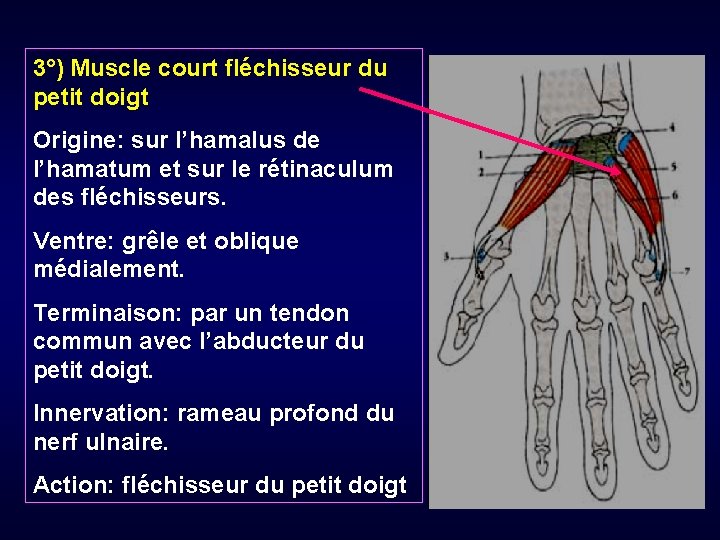 3°) Muscle court fléchisseur du petit doigt Origine: sur l’hamalus de l’hamatum et sur