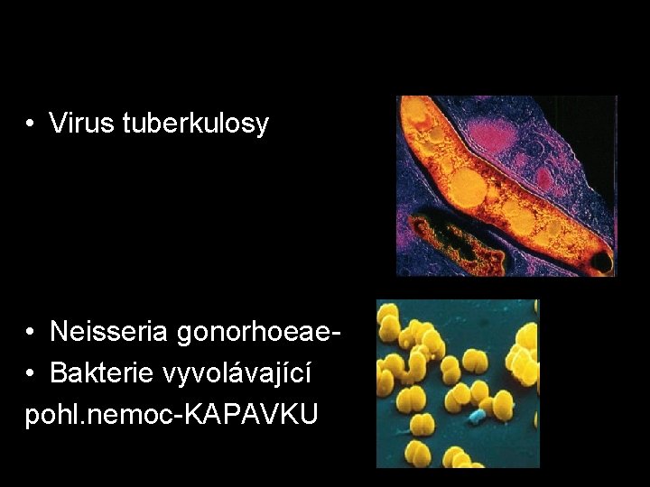  • Virus tuberkulosy • Neisseria gonorhoeae • Bakterie vyvolávající pohl. nemoc-KAPAVKU 