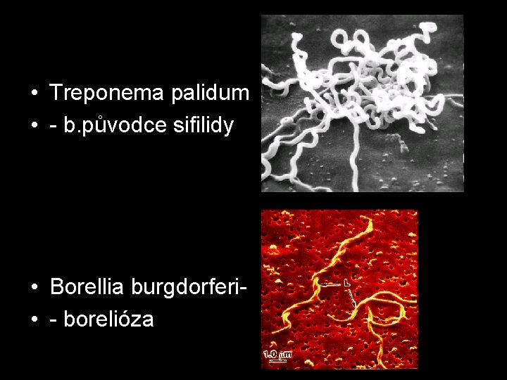  • Treponema palidum • - b. původce sifilidy • Borellia burgdorferi • -