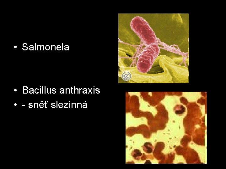  • Salmonela • Bacillus anthraxis • - sněť slezinná 