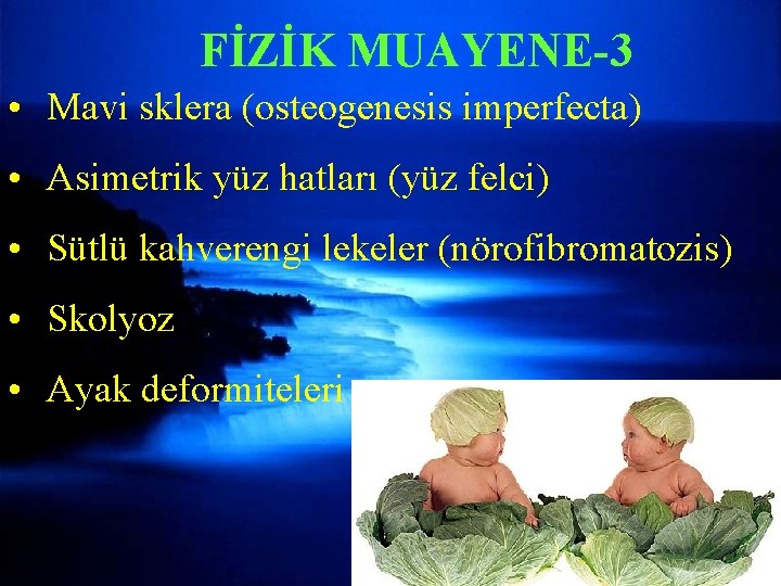 FİZİK MUAYENE-3 • Mavi sklera (osteogenesis imperfecta) • Asimetrik yüz hatları (yüz felci) •