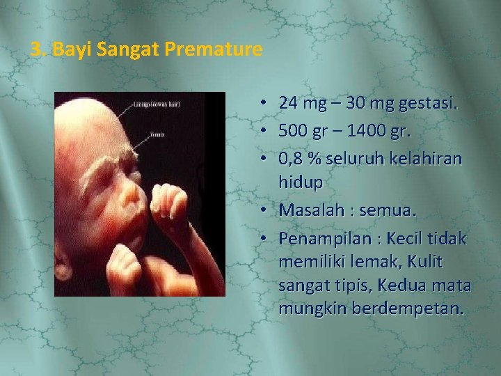 3. Bayi Sangat Premature 24 mg – 30 mg gestasi. 500 gr – 1400