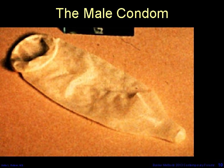 The Male Condom Anita L. Nelson, MD Barrier Methods 2013 Contemporary Forums 10 