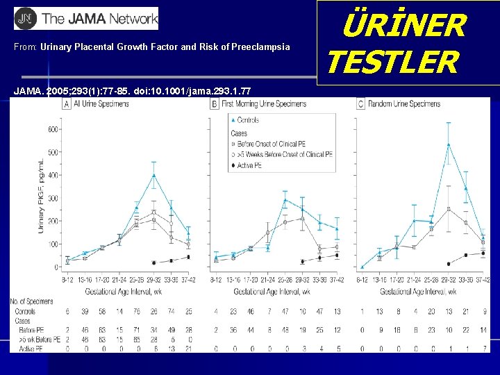 From: Urinary Placental Growth Factor and Risk of Preeclampsia JAMA. 2005; 293(1): 77 -85. From: Urinary Placental Growth Factor and Risk of Preeclampsia JAMA. 2005; 293(1): 77 -85.