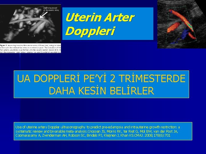 Uterin Arter Doppleri UA DOPPLERİ PE’Yİ 2 TRİMESTERDE DAHA KESİN BELİRLER Use of uterine