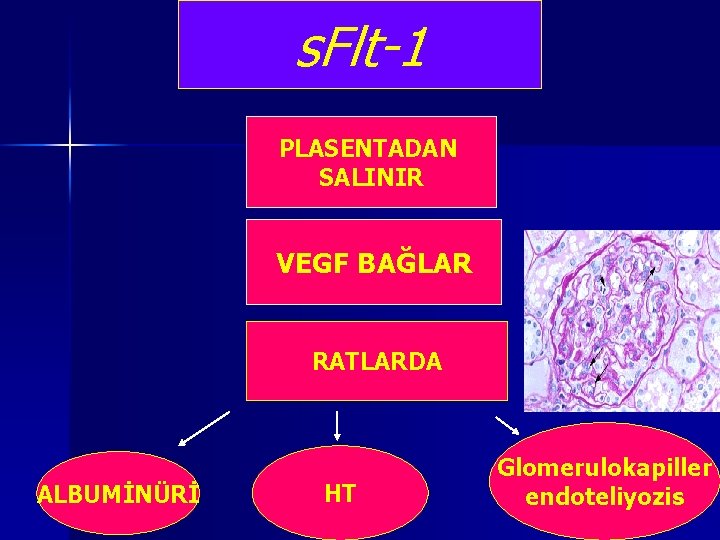 s. Flt-1 PLASENTADAN SALINIR VEGF BAĞLAR RATLARDA ALBUMİNÜRİ HT Glomerulokapiller endoteliyozis s. Flt-1 PLASENTADAN SALINIR VEGF BAĞLAR RATLARDA ALBUMİNÜRİ HT Glomerulokapiller endoteliyozis