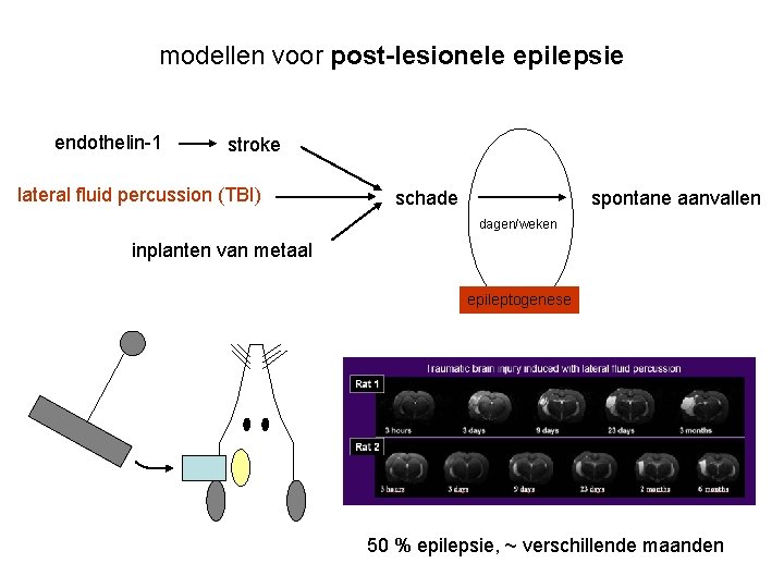 modellen voor post-lesionele epilepsie endothelin-1 stroke lateral fluid percussion (TBI) schade spontane aanvallen dagen/weken