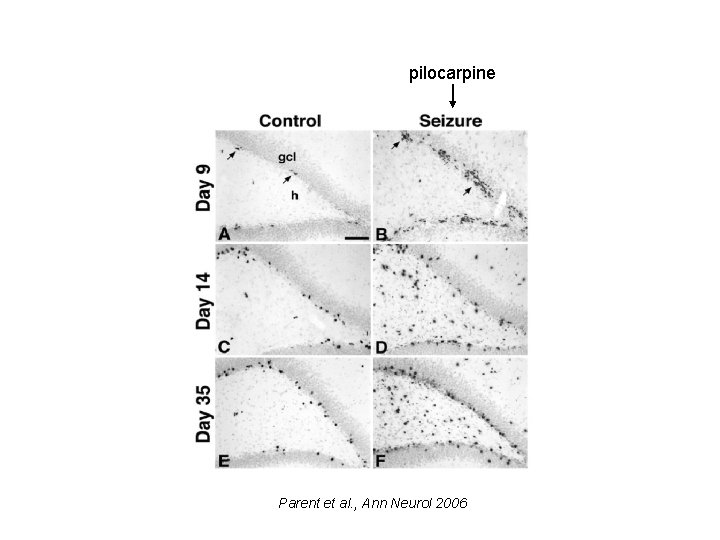 pilocarpine Parent et al. , Ann Neurol 2006 