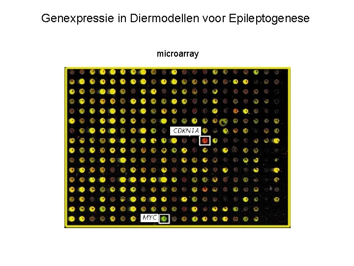 Genexpressie in Diermodellen voor Epileptogenese microarray 