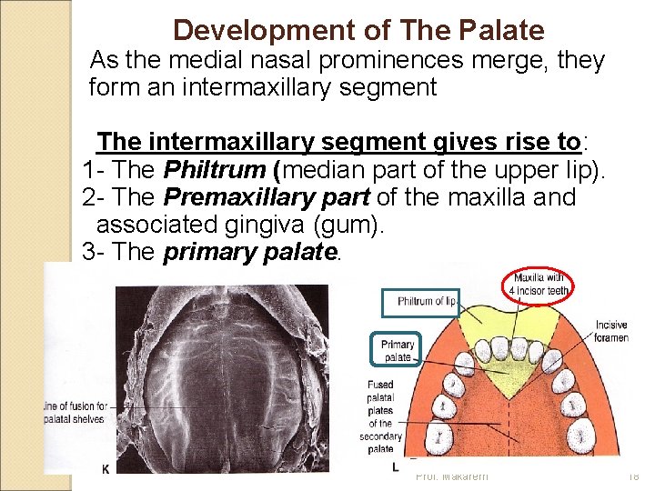 Development of The Palate As the medial nasal prominences merge, they form an intermaxillary