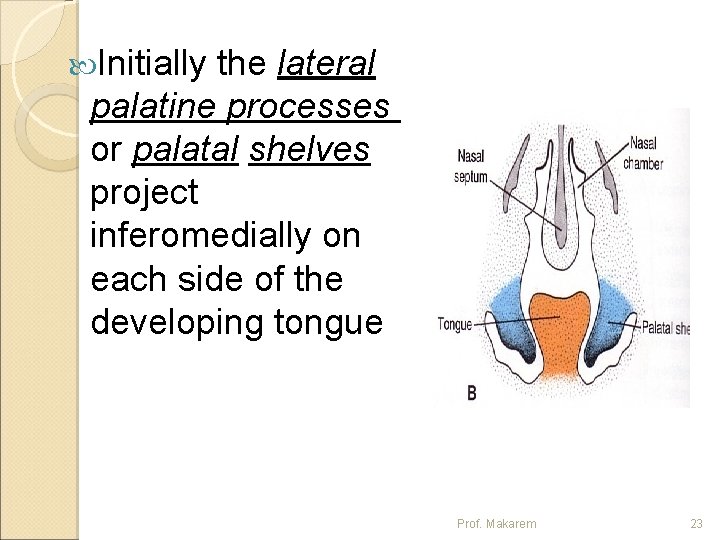  Initially the lateral palatine processes or palatal shelves project inferomedially on each side
