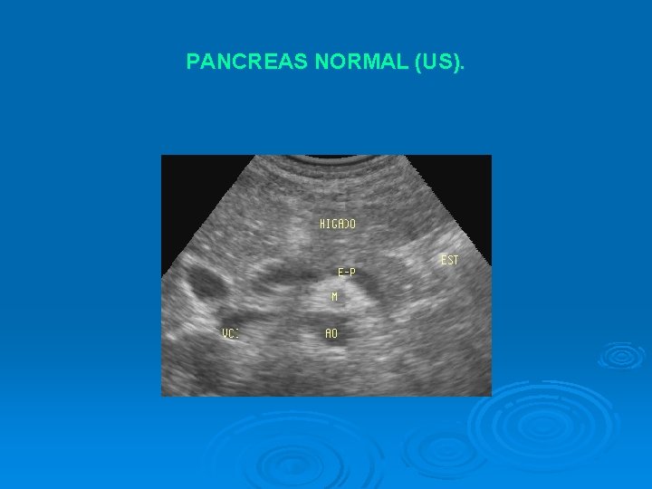 PANCREAS NORMAL (US). 