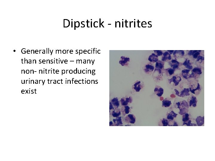 Dipstick - nitrites • Generally more specific than sensitive – many non- nitrite producing