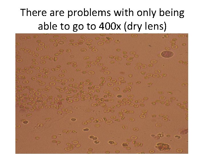 There are problems with only being able to go to 400 x (dry lens)