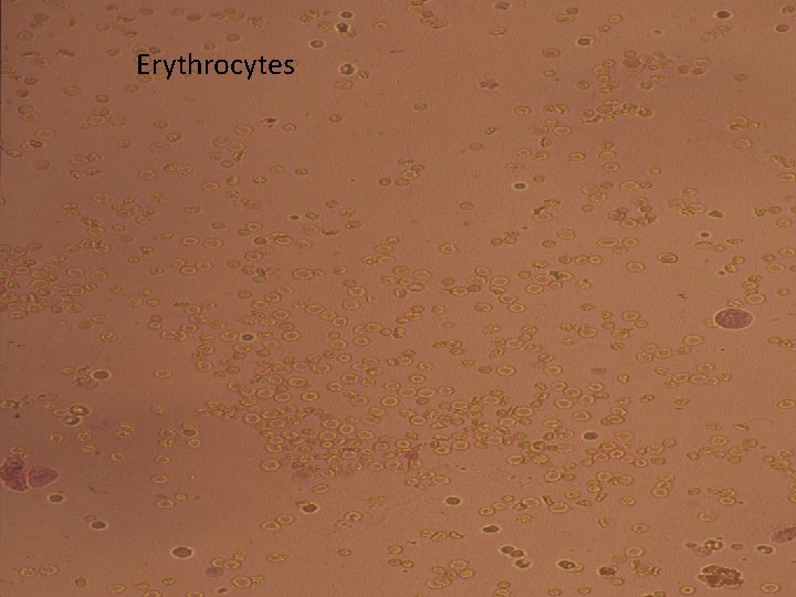 Erythrocytes 