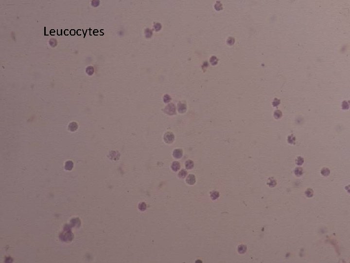 Leucocytes 