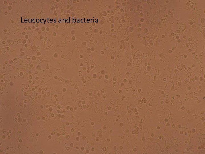 Leucocytes and bacteria 