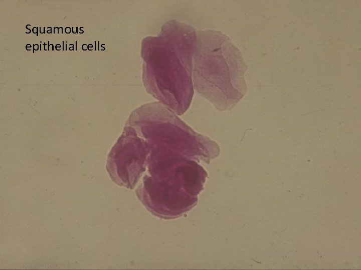 Squamous epithelial cells 