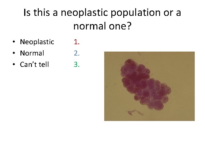 Is this a neoplastic population or a normal one? • Neoplastic • Normal •