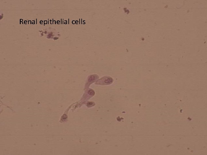 Renal epithelial cells 