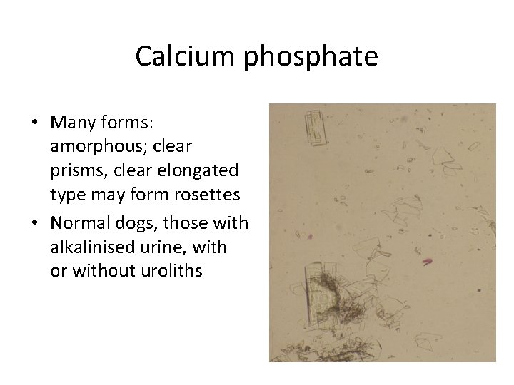 Calcium phosphate • Many forms: amorphous; clear prisms, clear elongated type may form rosettes