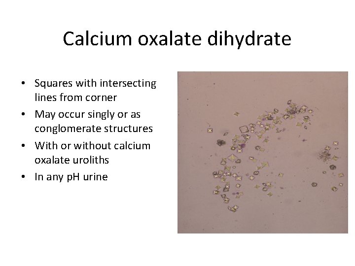 Calcium oxalate dihydrate • Squares with intersecting lines from corner • May occur singly
