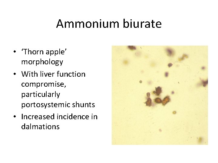 Ammonium biurate • ‘Thorn apple’ morphology • With liver function compromise, particularly portosystemic shunts