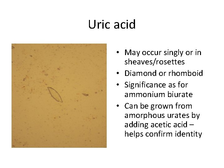 Uric acid • May occur singly or in sheaves/rosettes • Diamond or rhomboid •