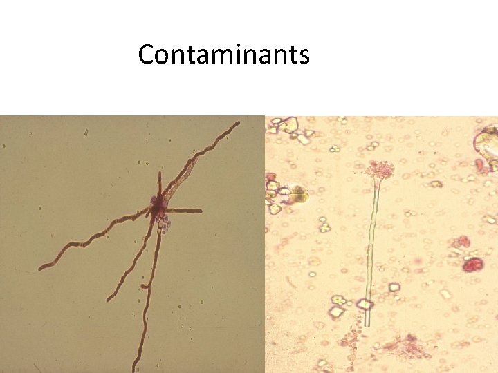 Contaminants 